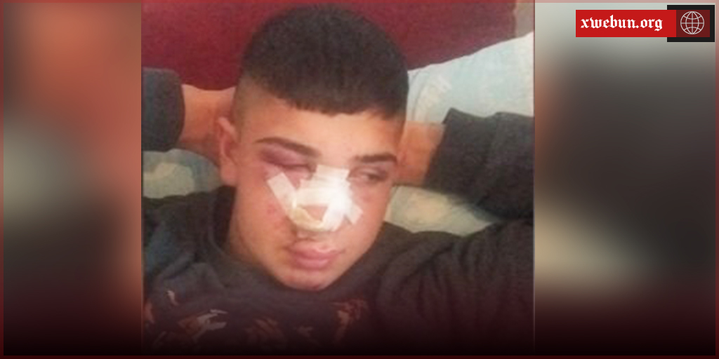 Anqara de vera kurdan hêrişo nîjadperestî