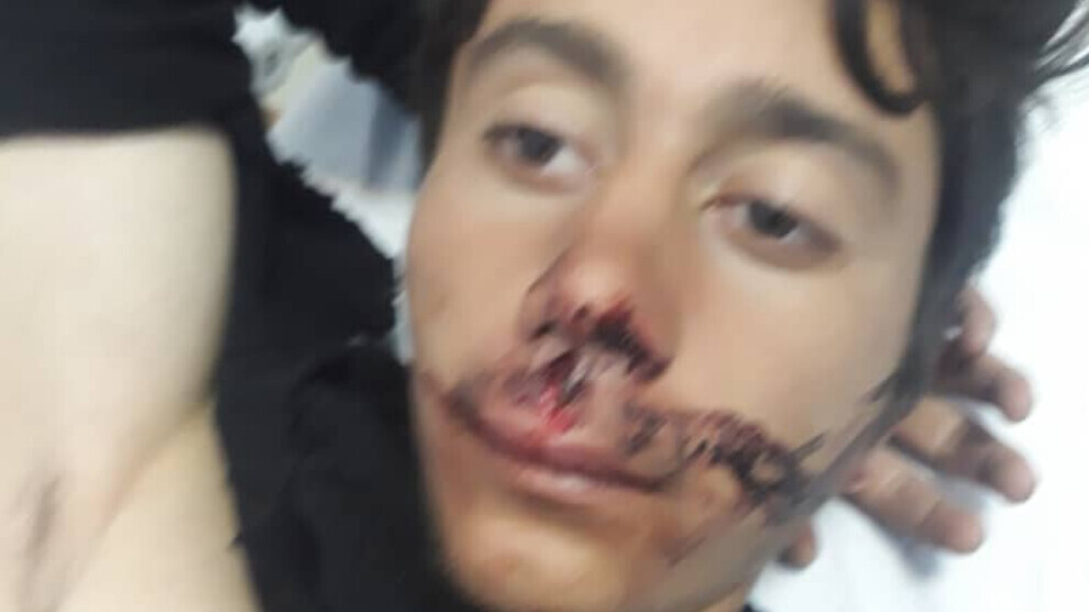 Li ser sînor kolberek hat kuştin