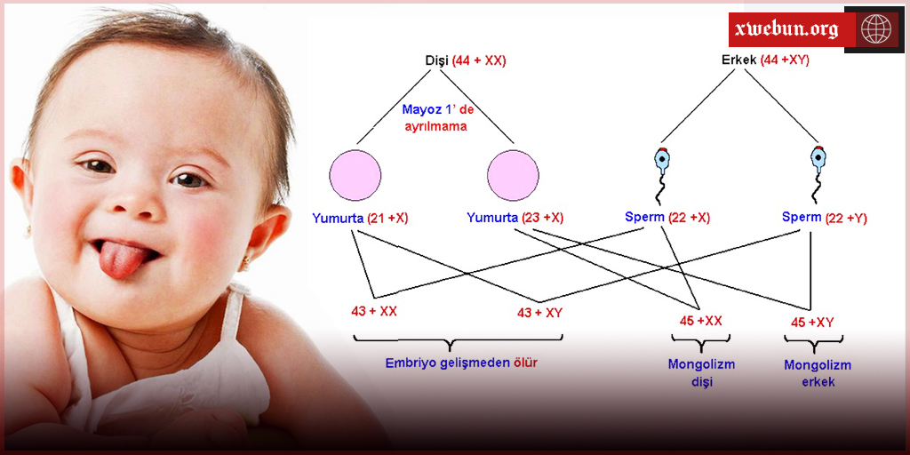 Nîşankoma (sendroma) downê